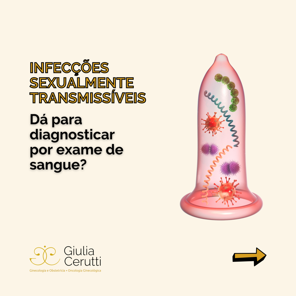 Infecções Sexualmente Transmissíveis Como Diagnosticar Dra Giulia Cerutti 6202
