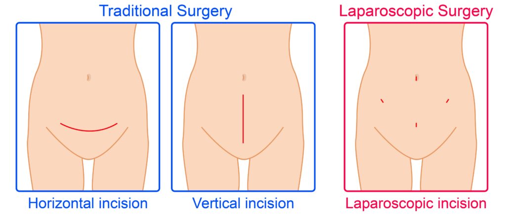 cirurgia