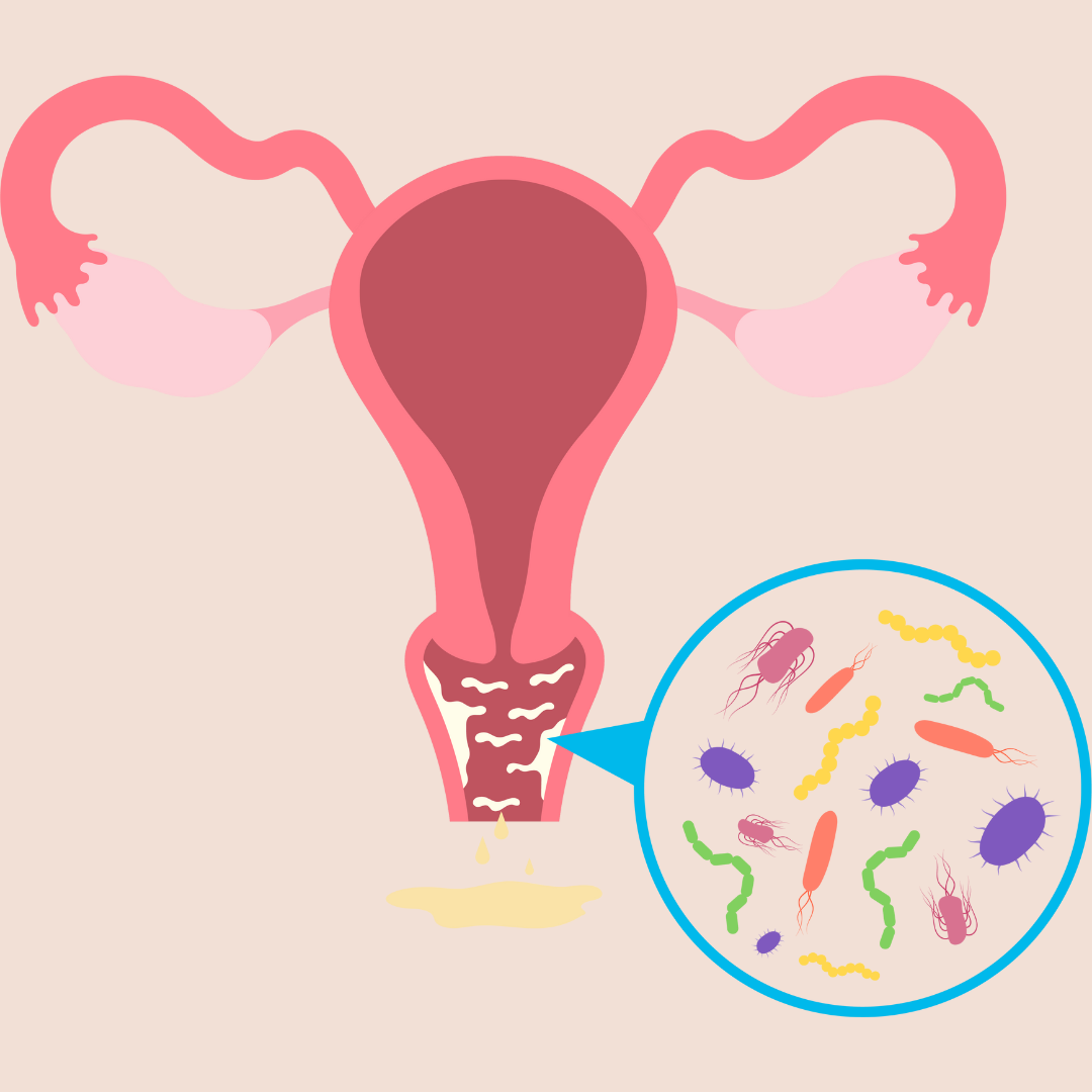 Corrimento vaginal – saiba o que fazer